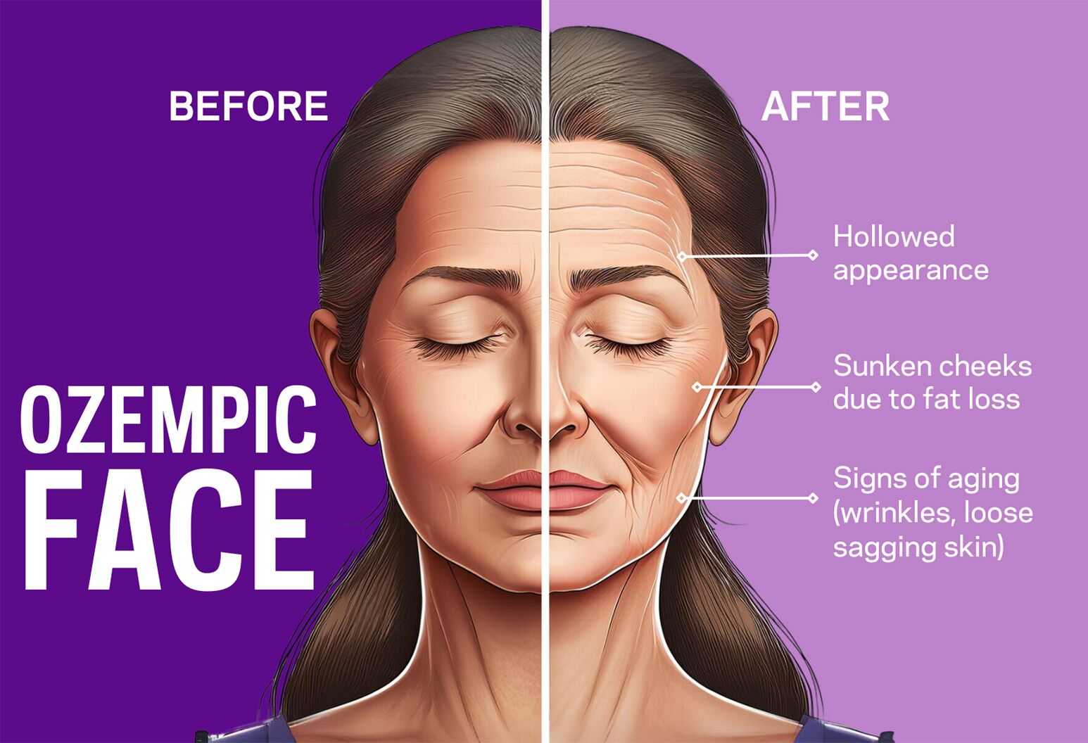 ozempic face before and after